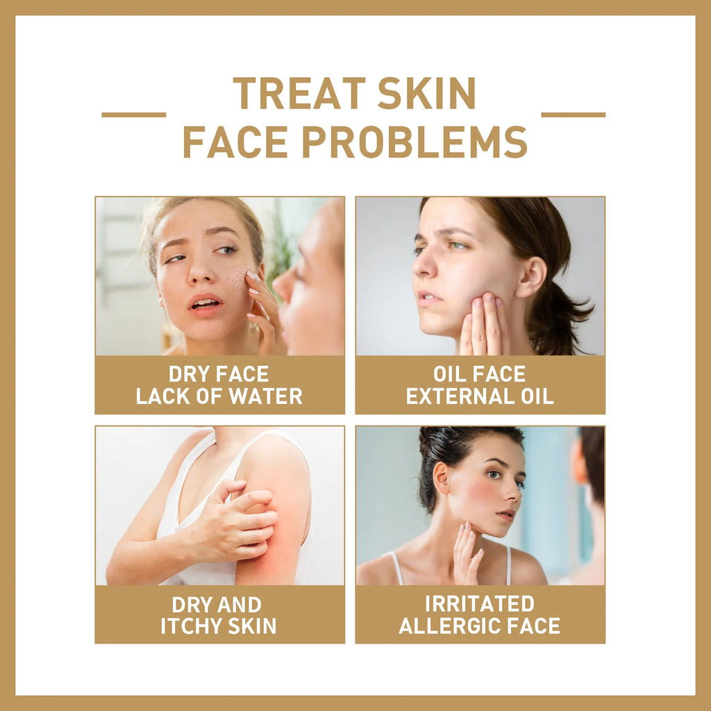 EELHOE Rice Toner Shrink Pores Oil Control Glow Skin Barrier Repair Care Niacinamide Deep Hydration Face Brightening Serum 150ml