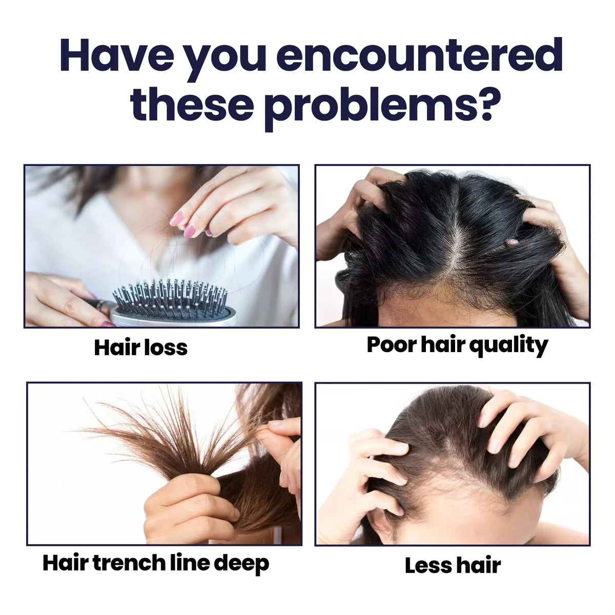 Hair Growth Spray Nourishing Moisturizing Thicker Longer Repair Damage Strengthen Scalp Treatment Hair Care Oil Products 50ml