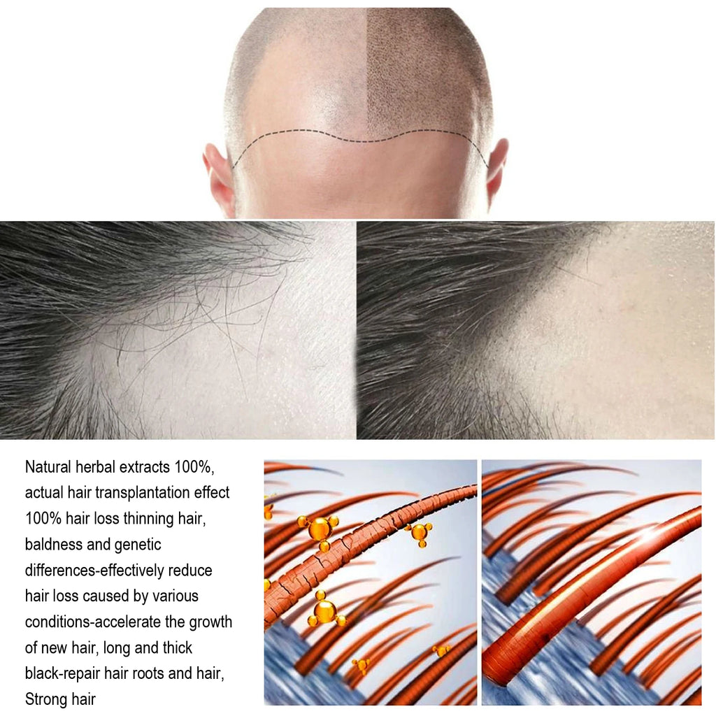 Hair Care Serum, Gently Nourishing, Massages the Scalp, Moisturizes and Smooths Hair, Hair Care Spray
